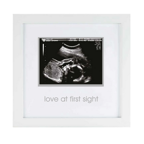 Sonogram frame