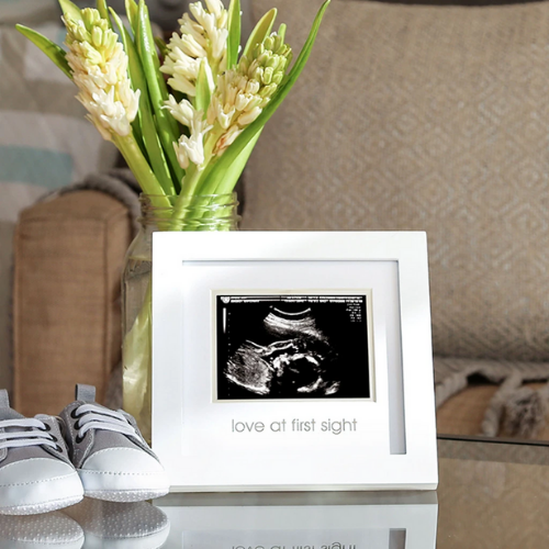 Sonogram frame